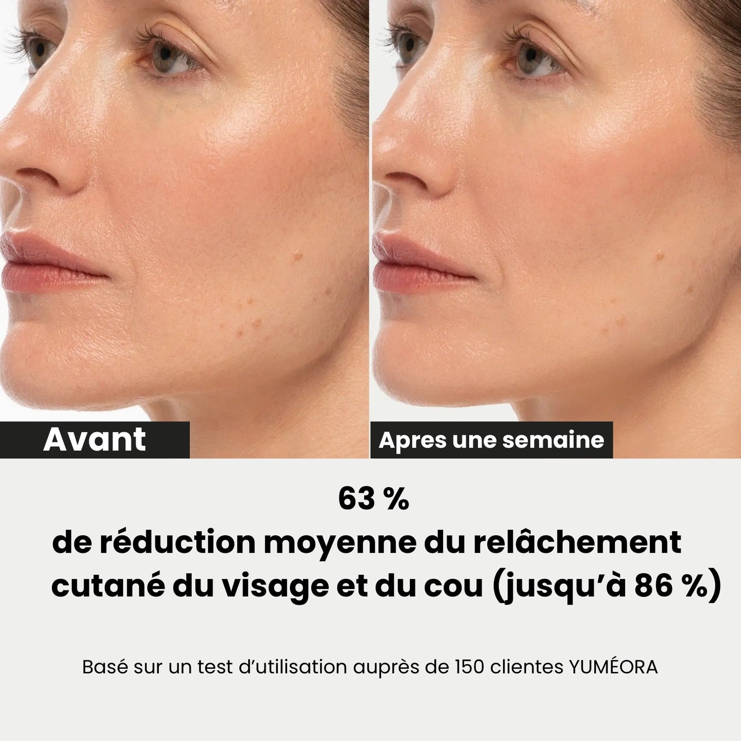 Masque liftant V-line à l'or 24K