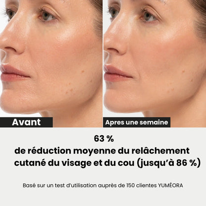 Masque liftant V-line à l'or 24K